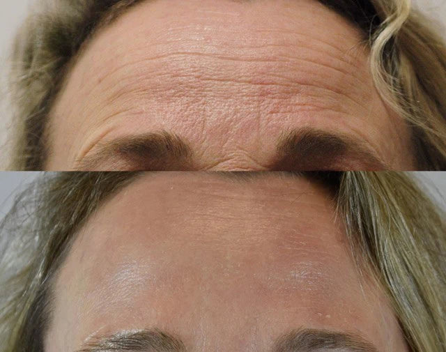 jehoon™ skin renewal set – komplett kollagen & kalcium anti-age rutin